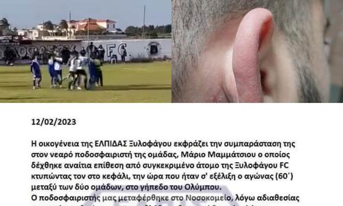 Καταγγελία Ελπίς: Παράγοντας της Ξυλοφάγου επιτέθηκε σε παίκτη μας (ΒΙΝΤΕΟ) thumb