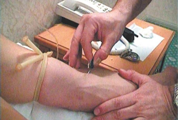 Ντόπινγκ στη Γιουβέντους των 90s: Αντικαταθλιπτικά, φάρμακα για την καρδιά και τον εγκέφαλο! thumb