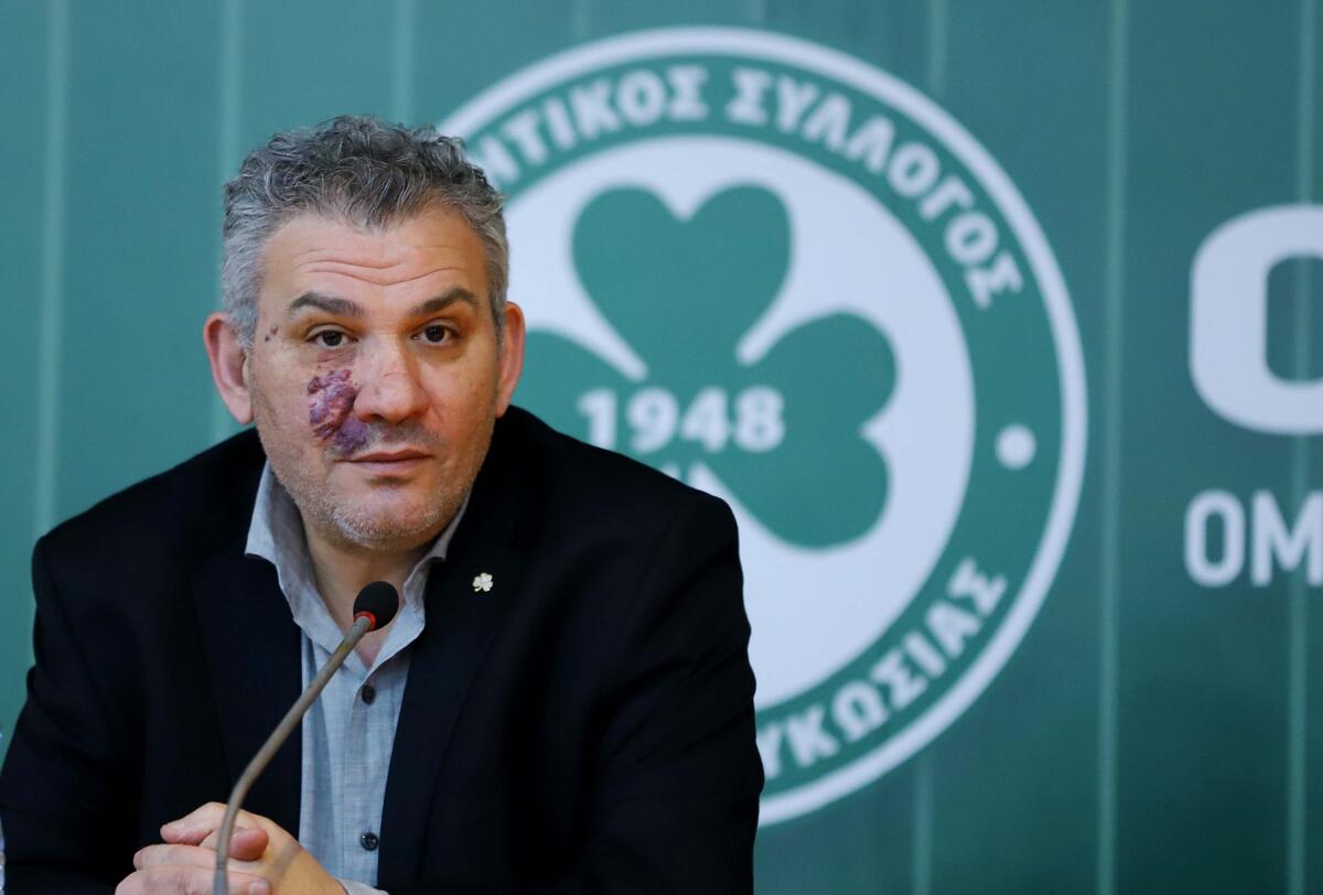 «Καταρχήν συμφωνία με τον Γκάρεθ Πάρκερ» thumb
