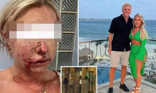 Σοκ στην Αγγλία: Ξυλοφόρτωσαν σύντροφο ποδοσφαιριστή της Ντέρμπι (pic) thumb